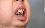 Samsun`da yaşıyor! Alt çenesi yok, dişleri üst damağında: Ameliyat için yardım bekliyor