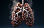Türkiye`de yılda ortalama 41 bin kişi akciğer kanserine yakalanıyor